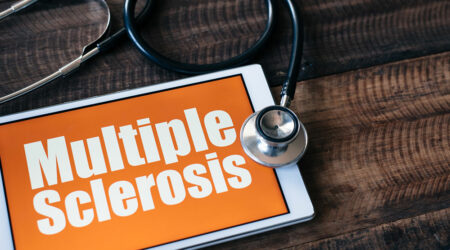 Here are some important things to keep in mind about multiple sclerosis