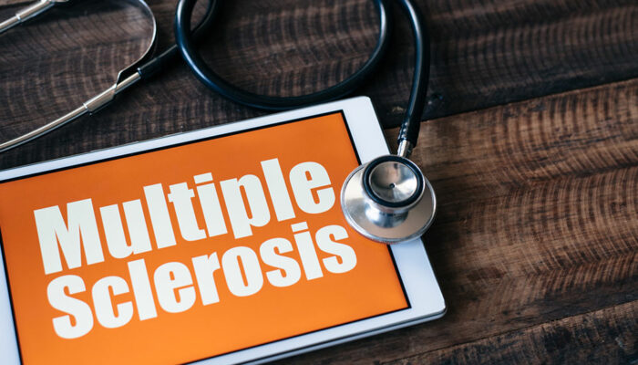 Here are some important things to keep in mind about multiple sclerosis