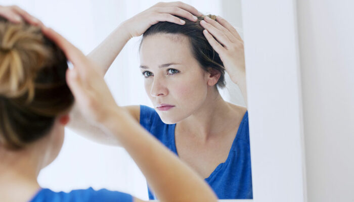 Medical conditions that can trigger severe hair loss