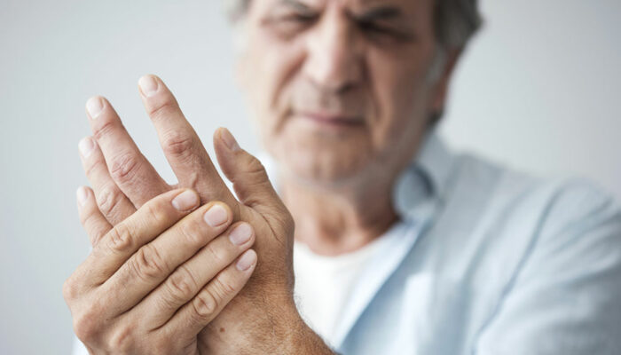 7 interesting facts about arthritis