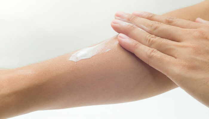 5 best lotions for eczema