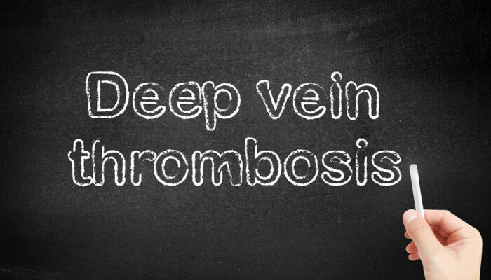 Early signs and risk factors of deep vein thrombosis