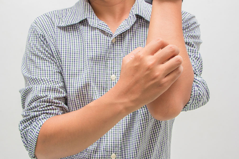 10 warning signs of eczema to watch out for