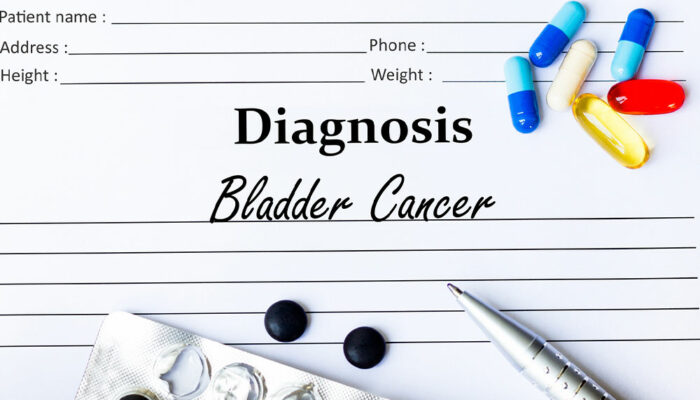 Warning signs that could indicate bladder cancer